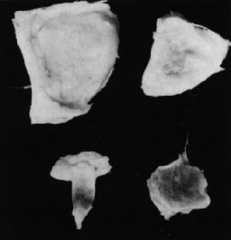 Pulp segments and ovule of seedless clone (left) and seeded clone (right) of cupuassu
