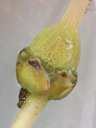 Arbutus unedo (Madroño) - Detalle del ovario tuberculado con el estilo surcado; hay restos del cáliz. (se ha quitado la corola)